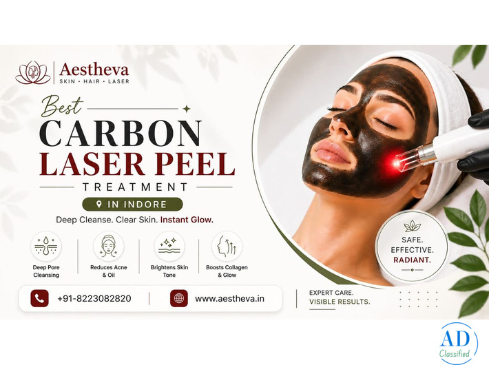 Best Carbon Laser Peel Treatment in Indore – Aestheva