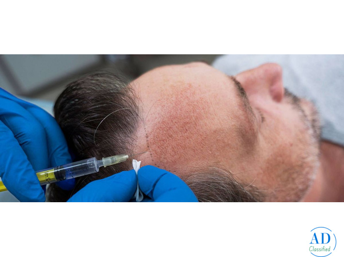 Regain Confidence with the Best Hair Transplant Specialist in Delhi NCR