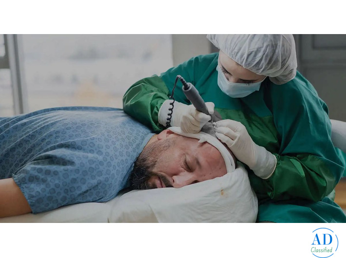 Regain Confidence with the Best Hair Transplant Specialist in Delhi NCR