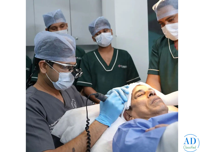 Regain Confidence with the Best Hair Transplant Specialist in Delhi NCR