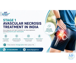 Stage 1 Avascular Necrosis Treatment in India – HipXpert