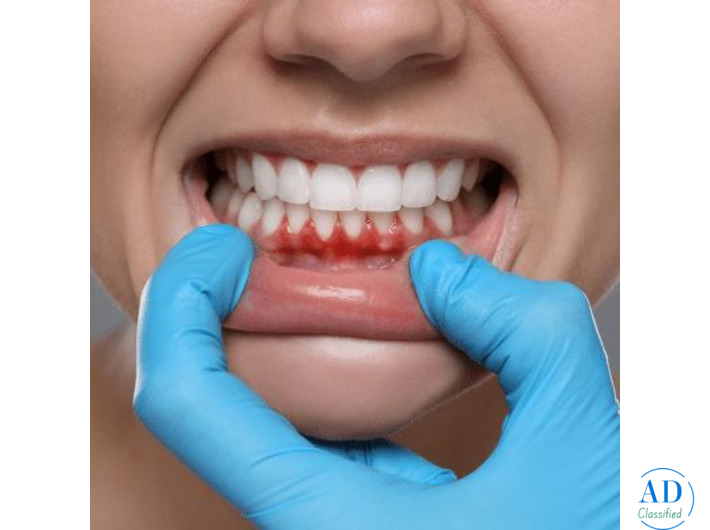 Best Dental in Preet Vihar | Expert Care at Dental Care Clinic