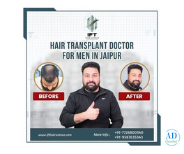 hair transplant doctor for men in Jaipur
