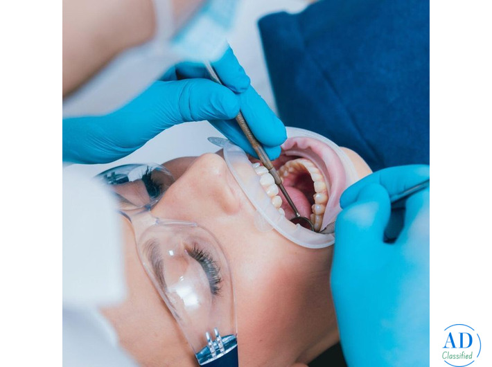 Root Canal Clinic in Ahmadabad – Pain Free RCT Treatment