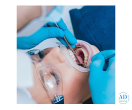 Root Canal Clinic in Ahmadabad – Pain Free RCT Treatment