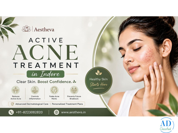 Active Acne Treatment in Indore – Aestheva