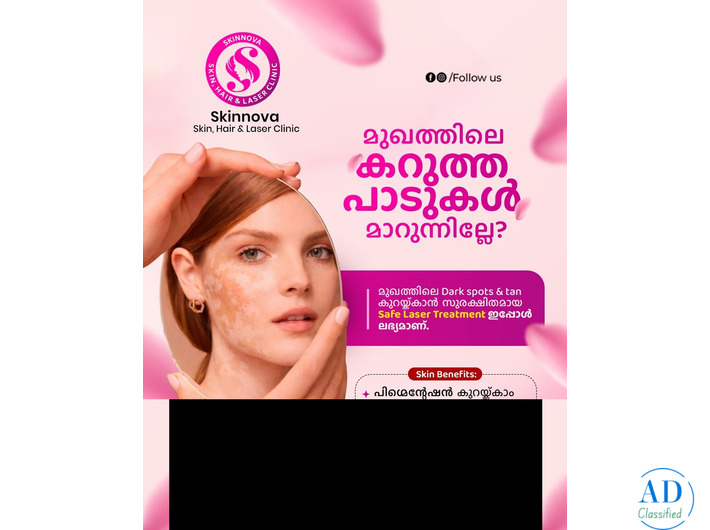 Skinnova Skin Clinic - Best Skin Clinic in Malappuram