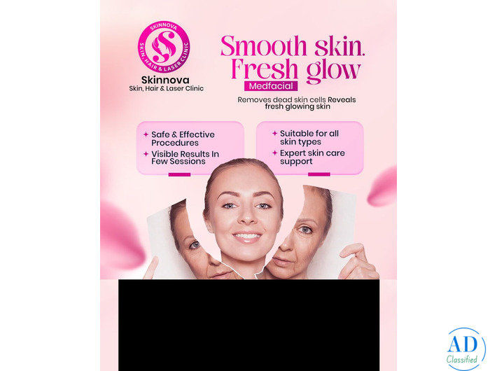 Skinnova Skin Clinic - Best Skin Clinic in Malappuram