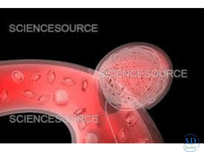Advanced Endovascular Coiling for Brain Aneurysm Treatment