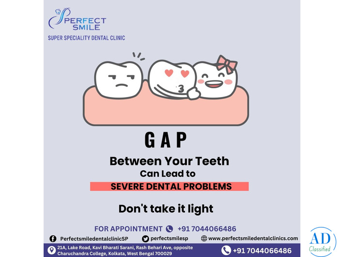 Perfect Smile Super Speciality Dental Clinic