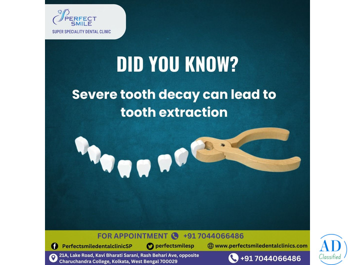 Perfect Smile Super Speciality Dental Clinic