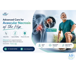 Advanced Non Surgical Treatments for Avascular Necrosis - HipXpert