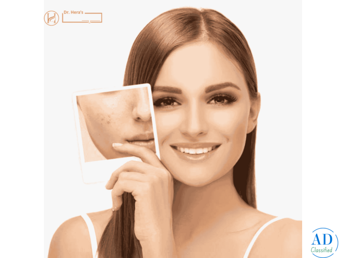 Advanced Dermatology Clinic in Roorkee