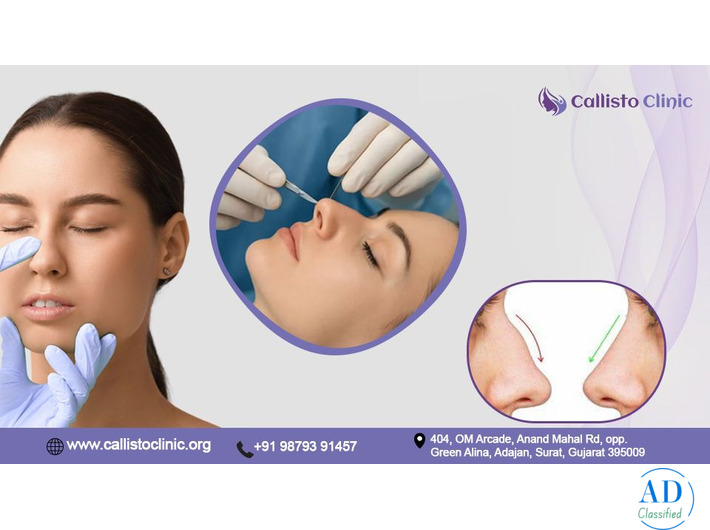 Transform Your Look with Rhinoplasty in Surat - Callisto Clinic