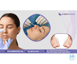 Transform Your Look with Rhinoplasty in Surat - Callisto Clinic