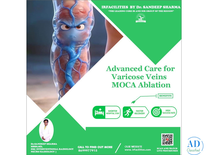 How to Choose the Best Doctor for Varicose Veins Treatment