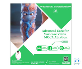 How to Choose the Best Doctor for Varicose Veins Treatment