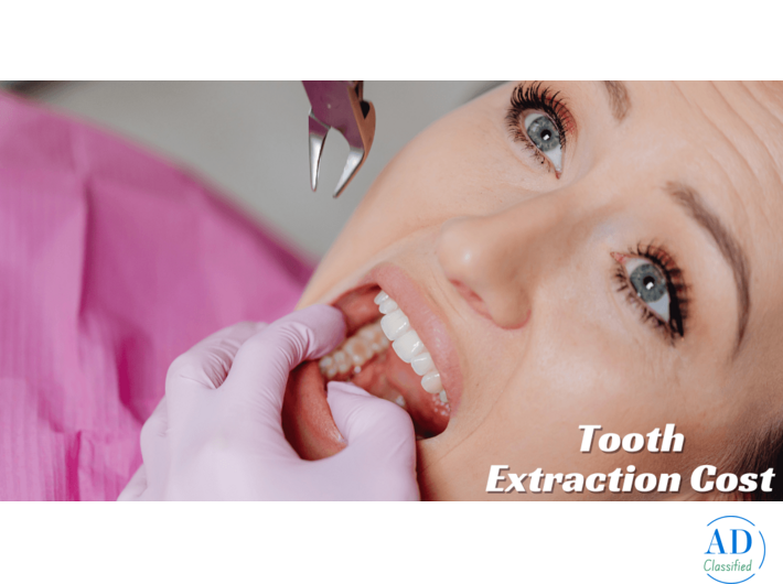 Understanding Tooth Extraction Cost in Mumbai