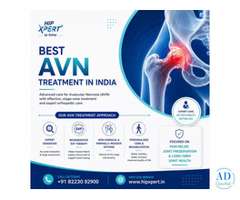 Best AVN Treatment in India – HipXpert
