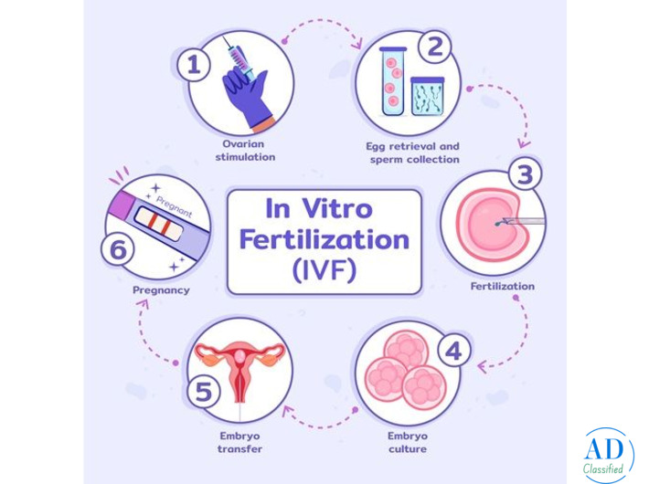 Understanding IVF Steps: A Guide to the IVF Treatment Process