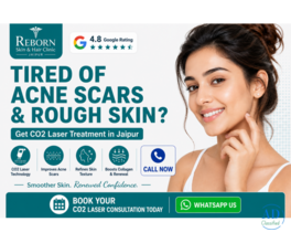 Advanced CO2 Laser Treatment in Jaipur for Skin Resurfacing