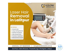 Laser Hair Removal in Lalitpur for Perfect Hairstyle