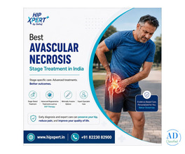 Best Avascular Necrosis Stage Treatment in India – HipXpert