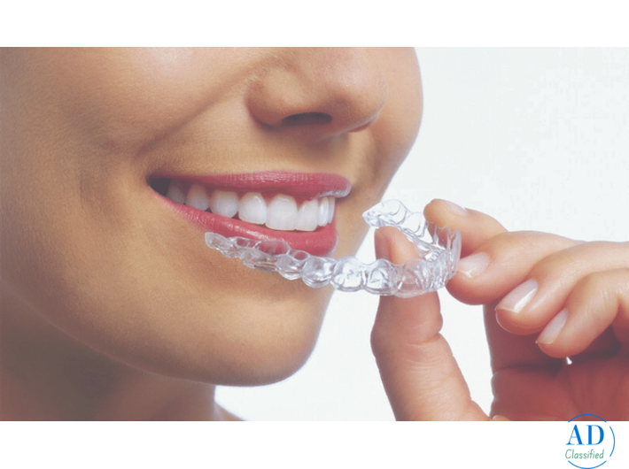 Best Invisalign Provider in Bikaner | Advanced Clear Aligner Solutions