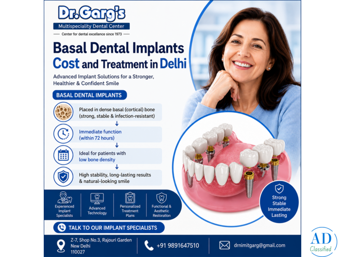 Basal Dental Implants Cost and Treatment in Delhi