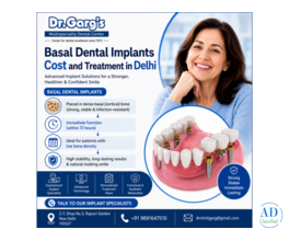 Basal Dental Implants Cost and Treatment in Delhi