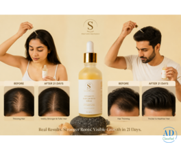 Advanced Hair Growth Serum — Organic Hair Serum for Hair Growth & Thickness | Sknlex