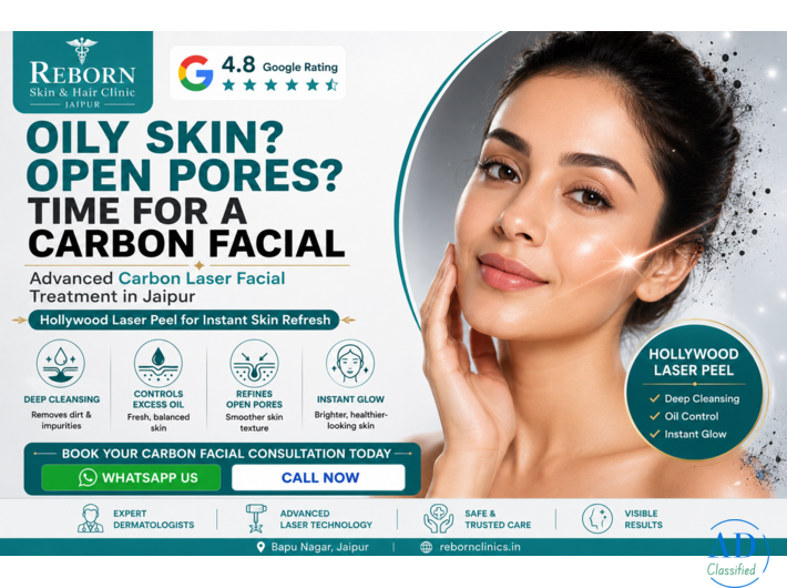 Carbon Laser Facial Treatment in Jaipur for Radiant Skin