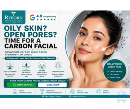 Carbon Laser Facial Treatment in Jaipur for Radiant Skin