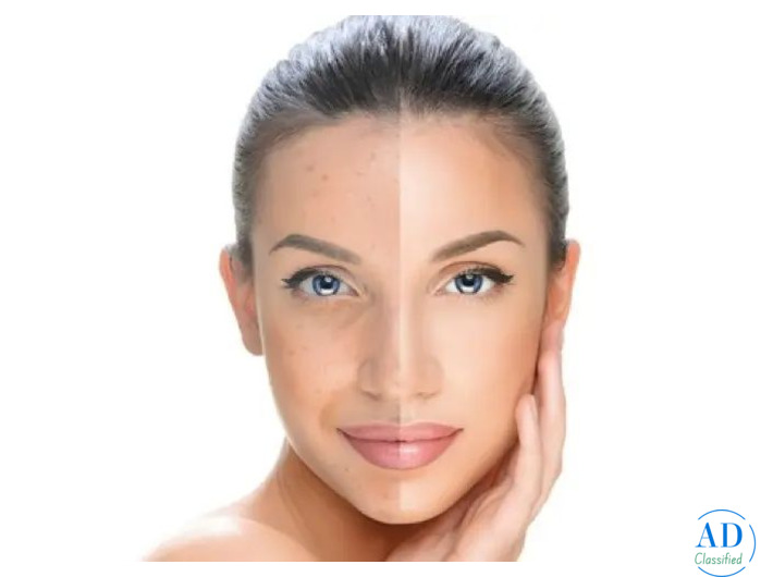 Best Skin Tightening Treatments in Pune | Arnica Clinic