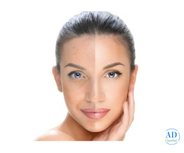 Best Skin Tightening Treatments in Pune | Arnica Clinic