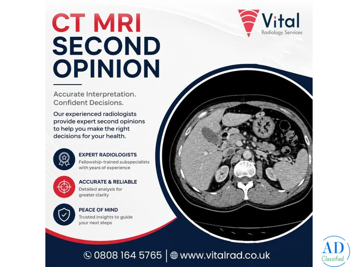 CT MRI Second Opinion Services for Expert Diagnostic Accuracy