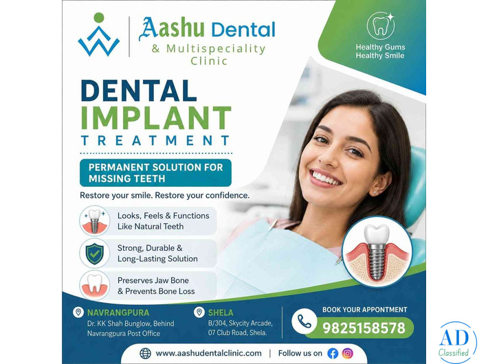 Dental Implants Treatment Ahmedabad | DR. Manish Shah