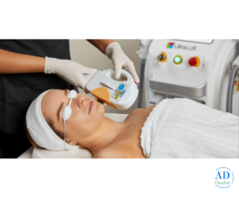 Acne Treatment for Clearer, Healthier Skin | Sculpt Body Clinics