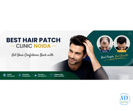 Best Hair Patch Clinic in Noida | Apolo Hair Studio
