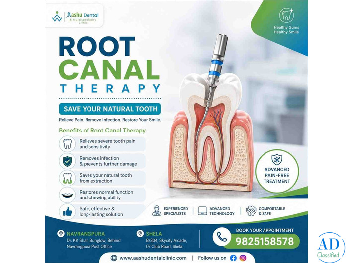 Get Rid of Tooth Pain with Expert Root Canal Therapy