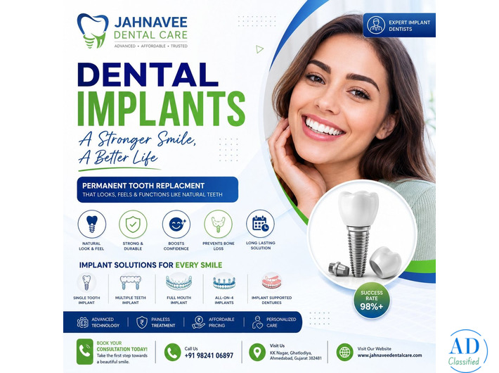 Dental Implants in Ahmedabad - Jahnavee Dental care