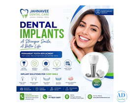 Dental Implants in Ahmedabad - Jahnavee Dental care