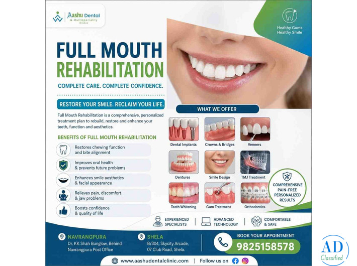 Full Mouth Rehabilitation in Navrangpura | DR. Manish Shah