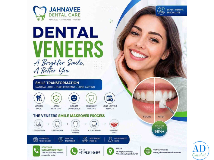 Cosmetic Dental Veneers Treatment - Jahnavee Dental care