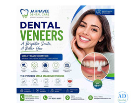 Cosmetic Dental Veneers Treatment - Jahnavee Dental care
