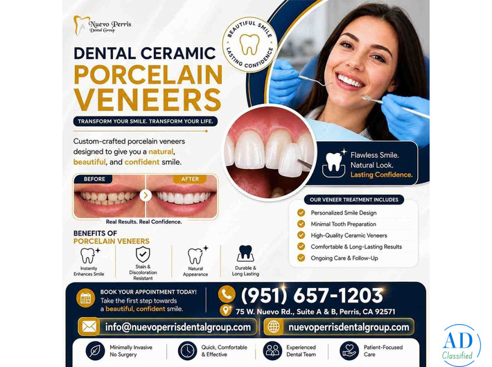 Dental Ceramic Porcelain Veneers California - Dr. Tejas Modi