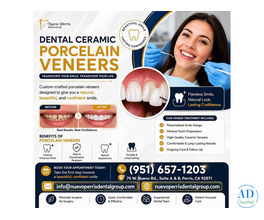 Dental Ceramic Porcelain Veneers California - Dr. Tejas Modi