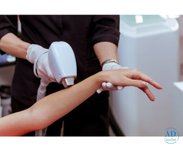 Exploring Laser Hair Removal Cost in Dubai and Its Long-Term Benefits