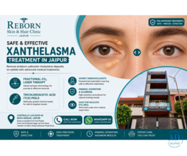 Xanthelasma Treatment in Jaipur for Eyelid Cholesterol Deposits