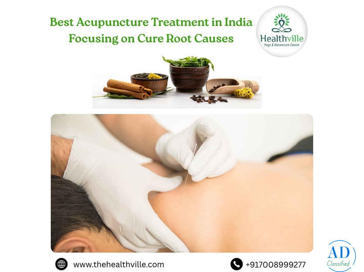 Best Acupuncture Treatment in India Focusing on Cure Root Causes
